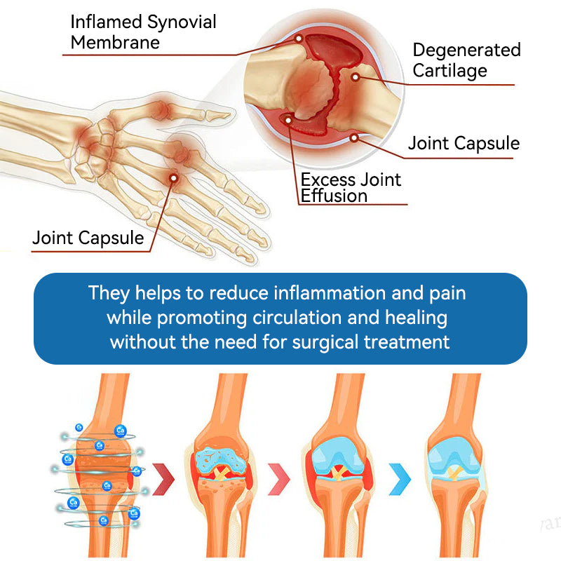 Juxek™ BPC-157 Joint Healing Cream 🦴Treats Arthritis, Neuropathy, Rheumatism, Sports Injuries & More👍