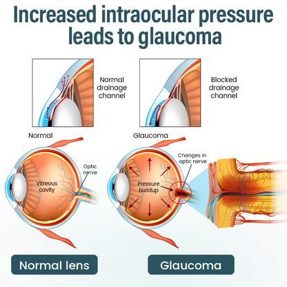 LOVILDS® OptiFusion Nano Eye Drops Serum