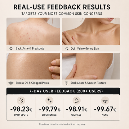 🧼 Niacinamide Brightening Soap for Dark Spots, Freckles, Acne Marks & Uneven Skin Tone